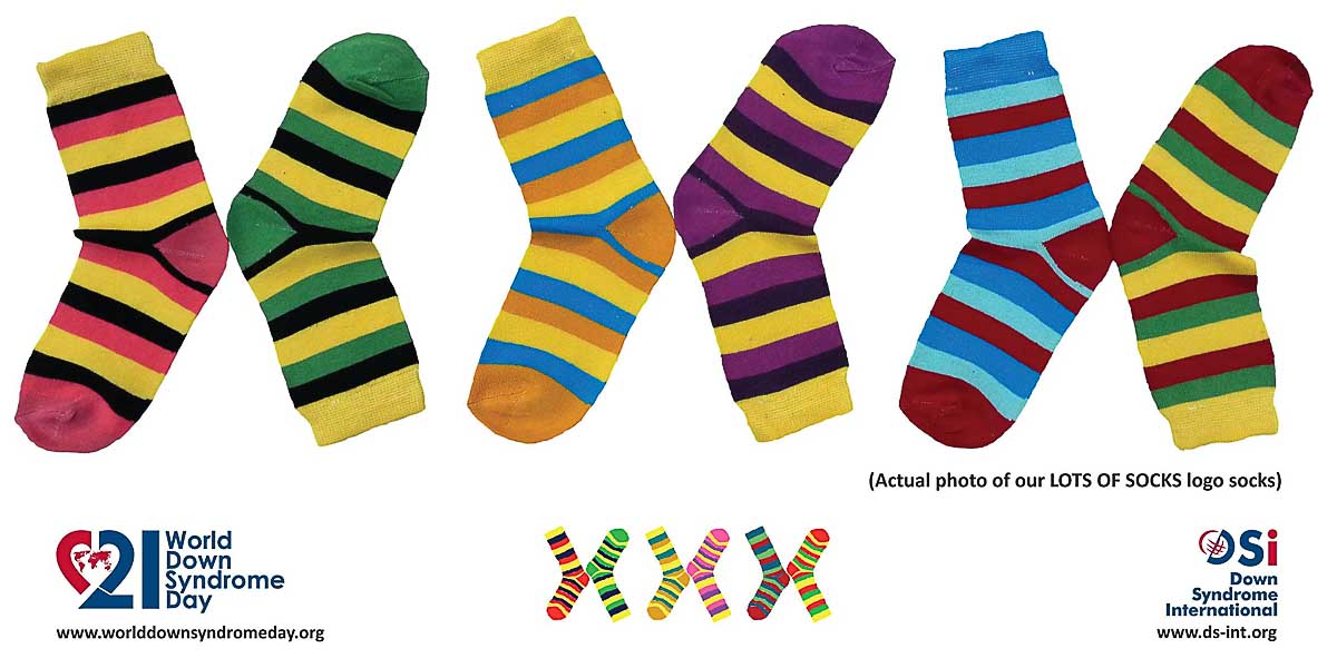 daunov sindrom daunov sindrom