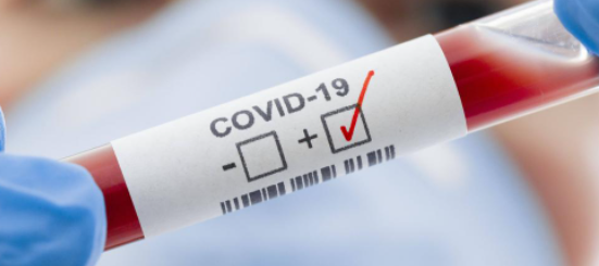 COVID-19, илустрација COVID-19, илустрација